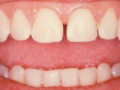 58
