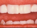 59
